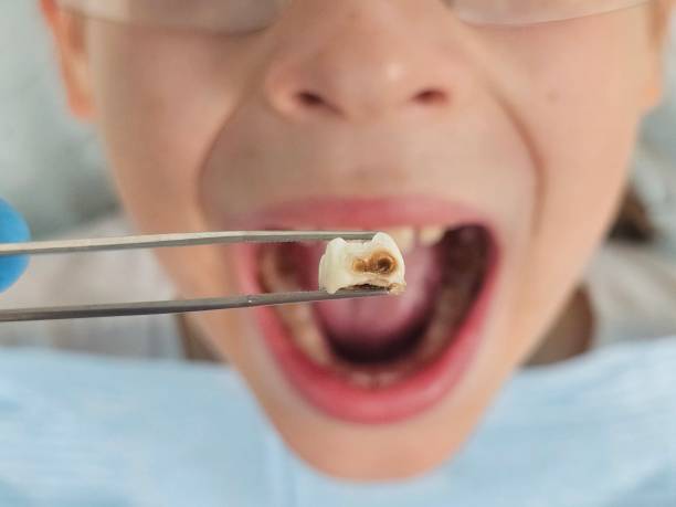 Best Walk-In Emergency Dentist in Laton, CA